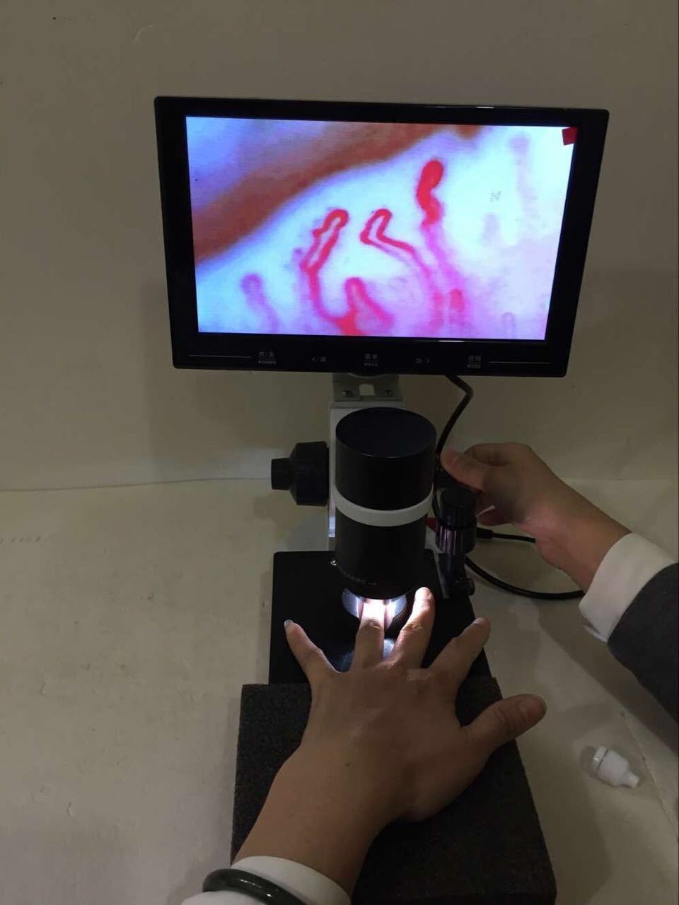 含屏3xx起,微循环检测仪,血流速检测仪,能量检测仪