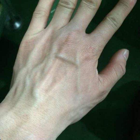 女性&ldquo;青筋&rdquo;凸起,意味着什么?99%的人都不知道!