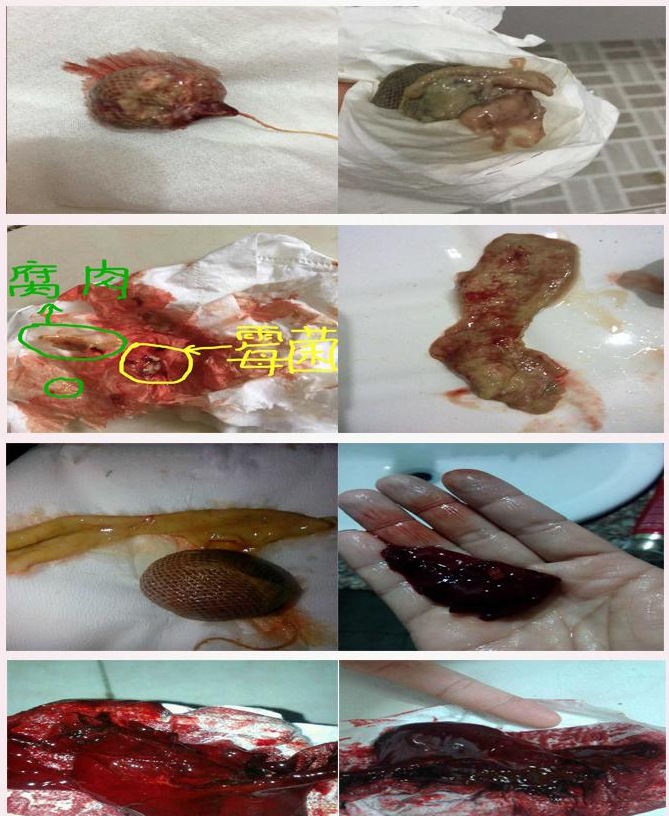 安陆顺坤元丹 妇科私处护理 抗菌止痒 正品