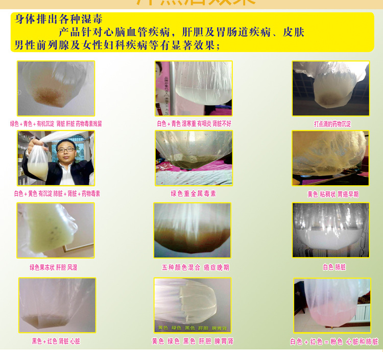 厂家供应沙棘排酸膏-美容院疏通经络排湿排酸膏汗蒸排湿oem贴牌