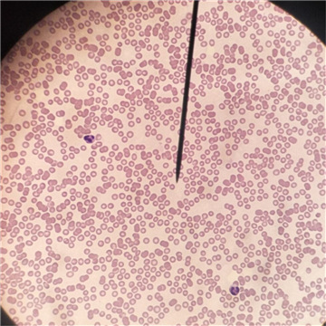 厂家爆款显微镜配套使用,实验室教学用----人血涂片 切片标本