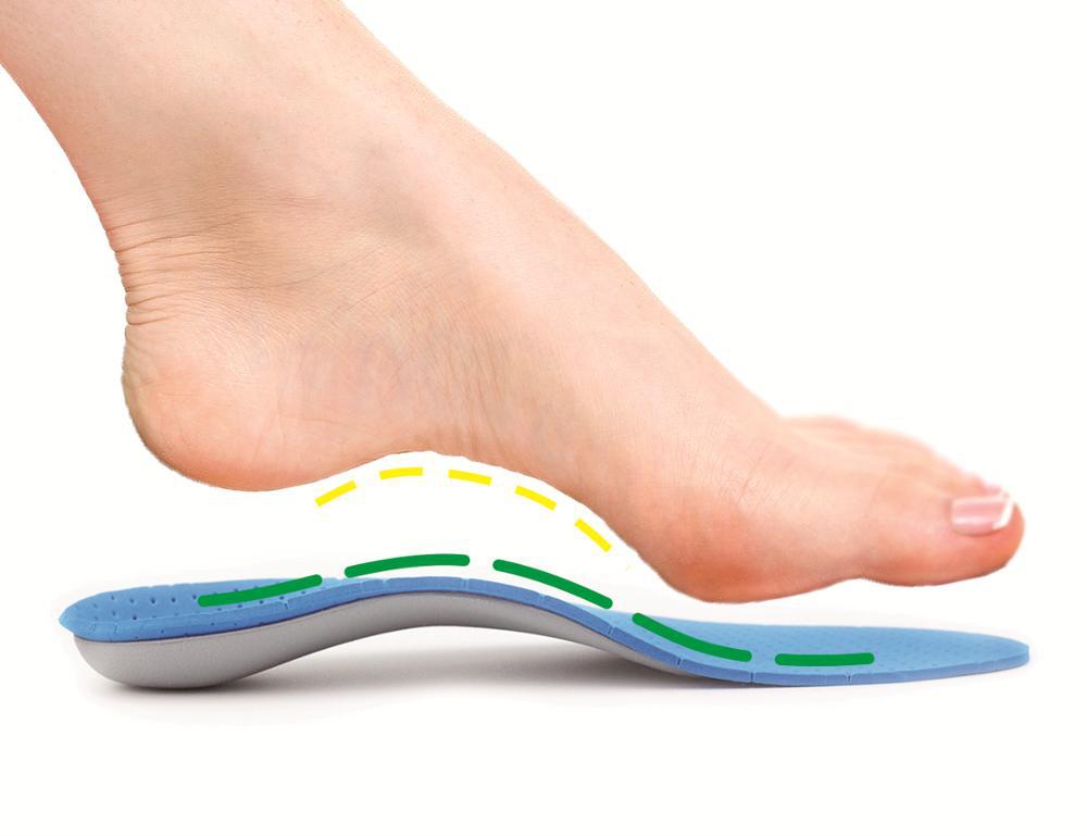 足弓鞋垫 后跟外翻 内外八字脚x形腿o型腿足弓支撑扁平足矫正鞋垫