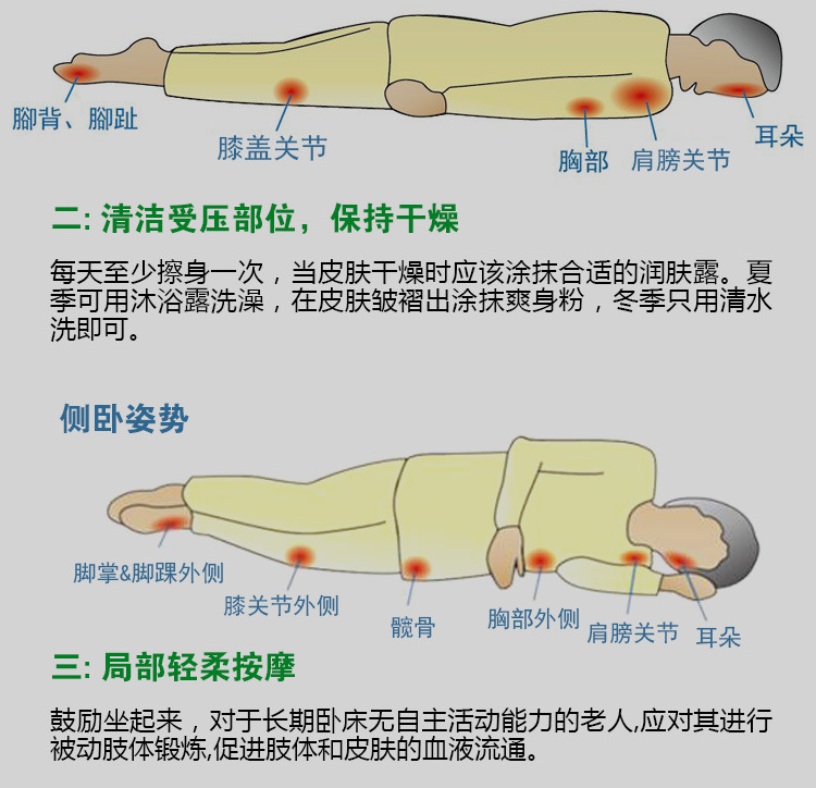 褥疮膏防褥疮充气床垫皮肤膏气床垫防褥疮祛腐 膏刀伤烫伤