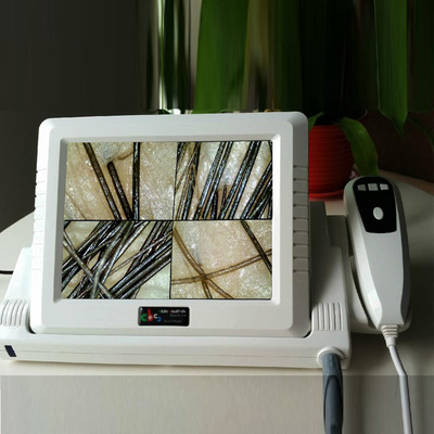 高清8寸液晶头皮毛发测试仪,头皮测试仪,毛囊检测仪