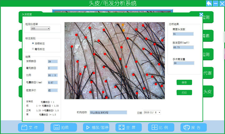 hot头皮毛发检测仪 皮肤毛囊测试仪 头皮理疗毛发护理检测一体机