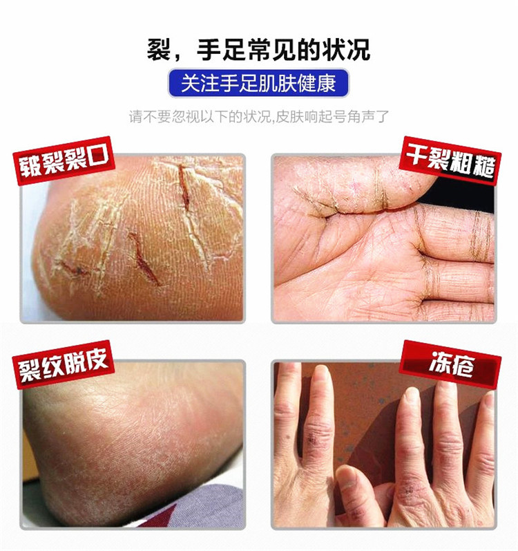 正品新喜乐爆拆灵林抗干裂修复霜 防冻裂肤裂灵手足干裂膏护手霜