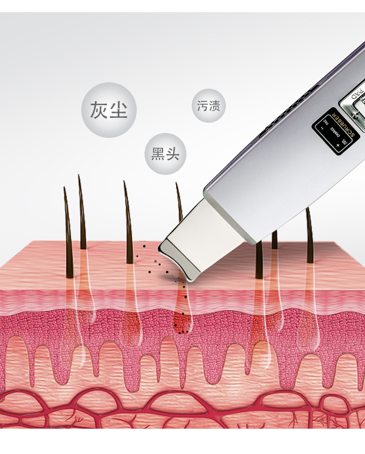 超声波铲皮机 美容铲皮机 去死皮