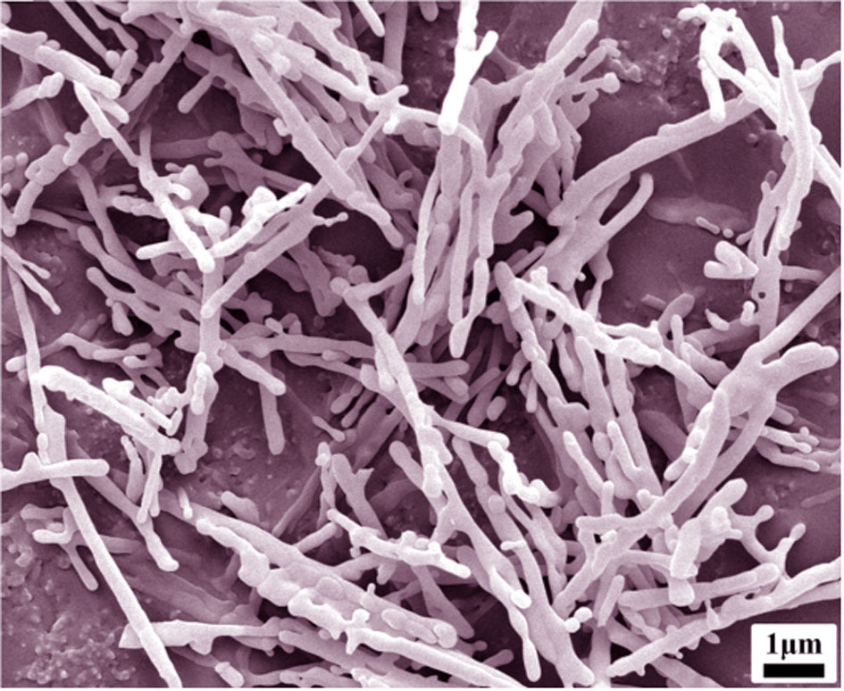 纳米晶须 陶瓷晶须 氧化铝晶须 al2o3 whisker