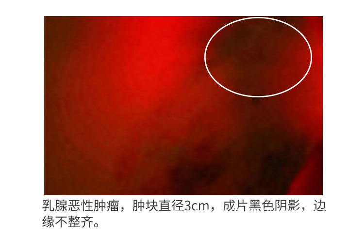 包邮便携式乳腺检测仪器远红外线乳透仪箱式乳房胸部检测仪