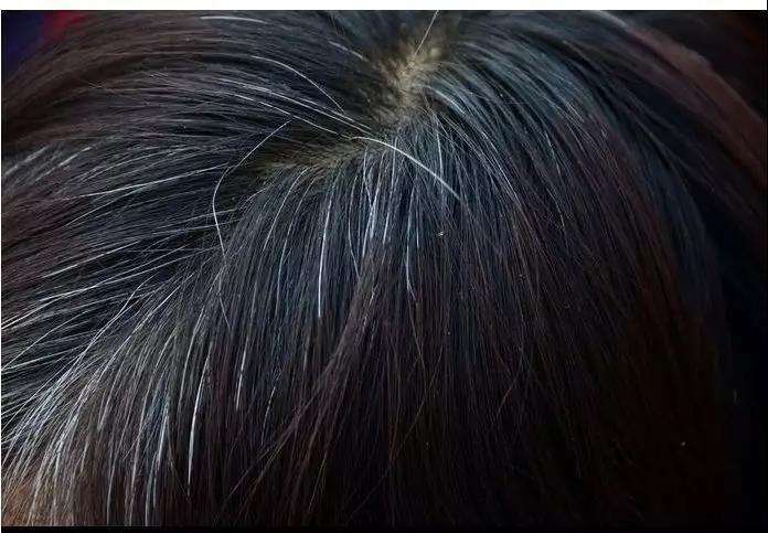 白头发的克星有哪些?