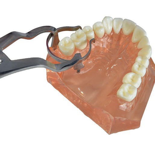 豆瓣补牙专用成型片100片装 钳 附加楔形