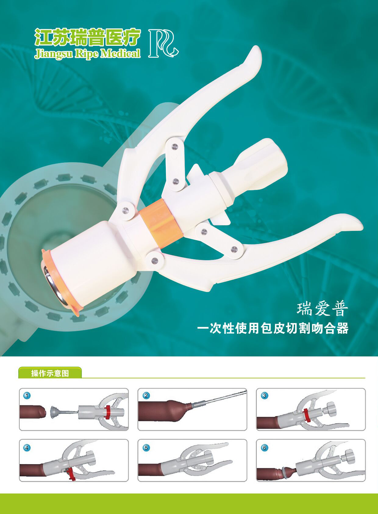 新型包皮环切术_word文档在线阅读与下载_无忧文档