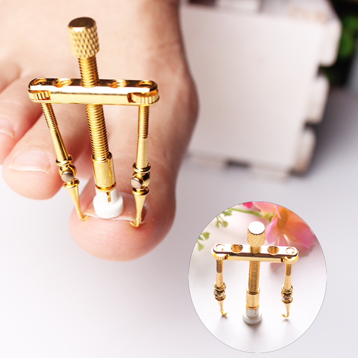 嵌甲矫正器纯铜甲沟专用内嵌工具脚趾甲往肉里长卷甲修正纠正器