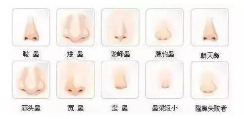 【美容】 这个夏天,让你鼻须美!一生约