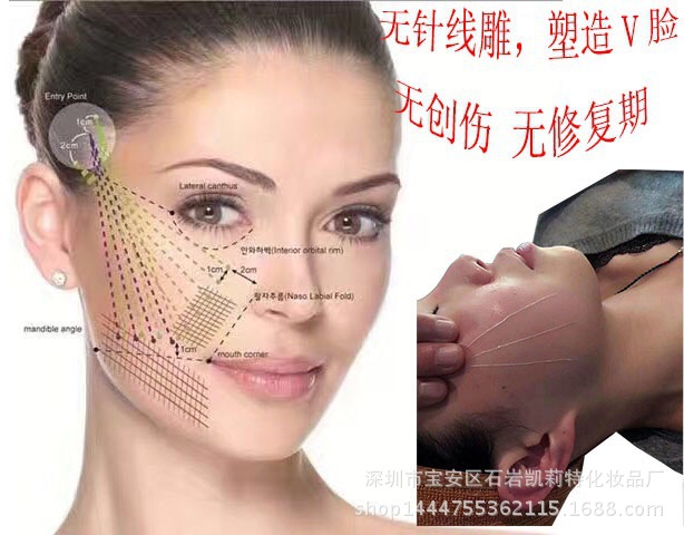 12根 黄金线雕蚕丝蛋白 水溶蛋白线 提拉紧致淡皱可溶魔力线