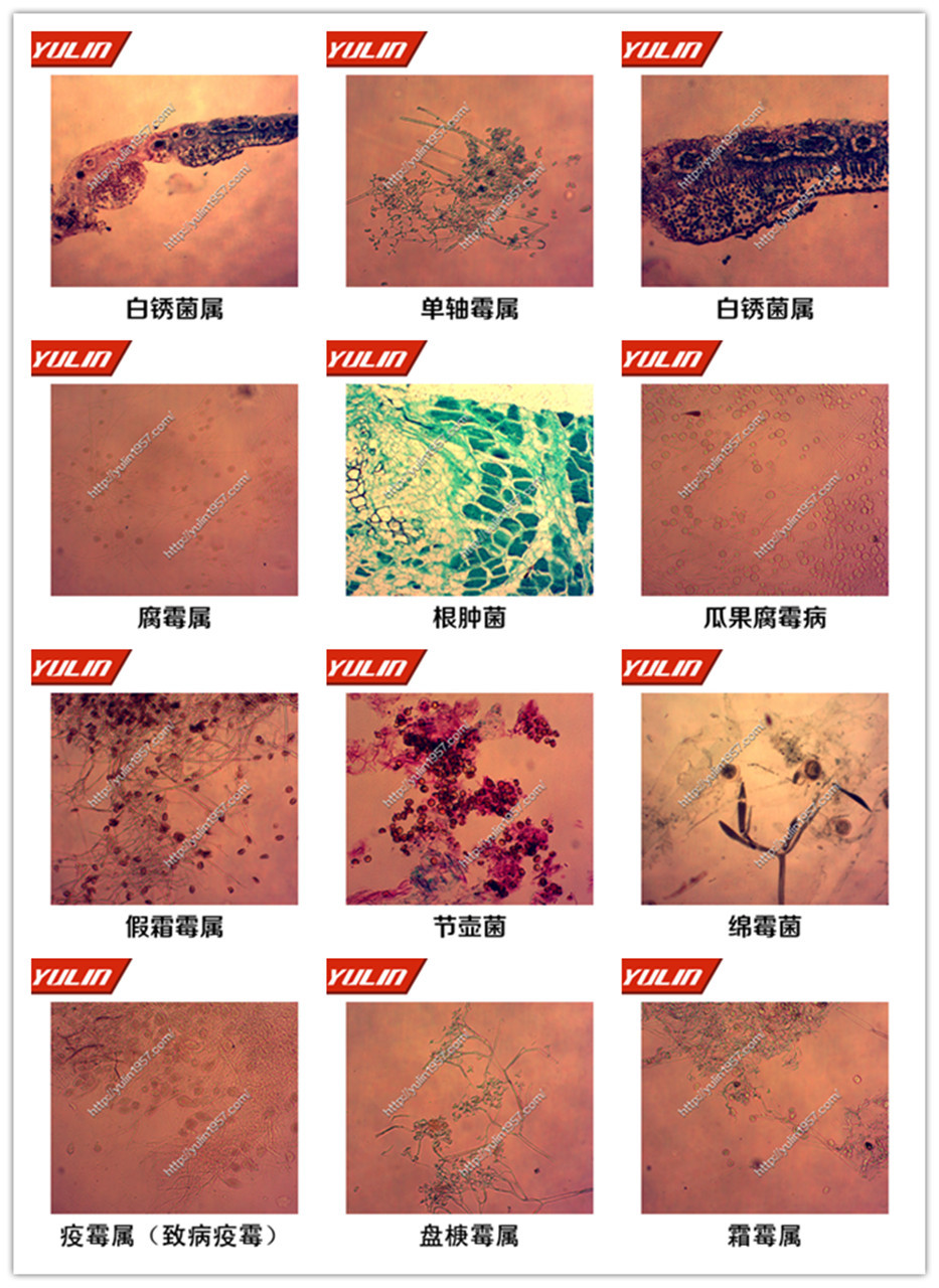 植物病理学鞭毛菌生物实验生物玻片标本 霜霉属