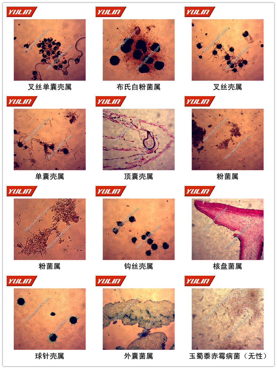 植物病理学子囊菌物切片标本高清晰植物病理类 叉丝单囊壳属