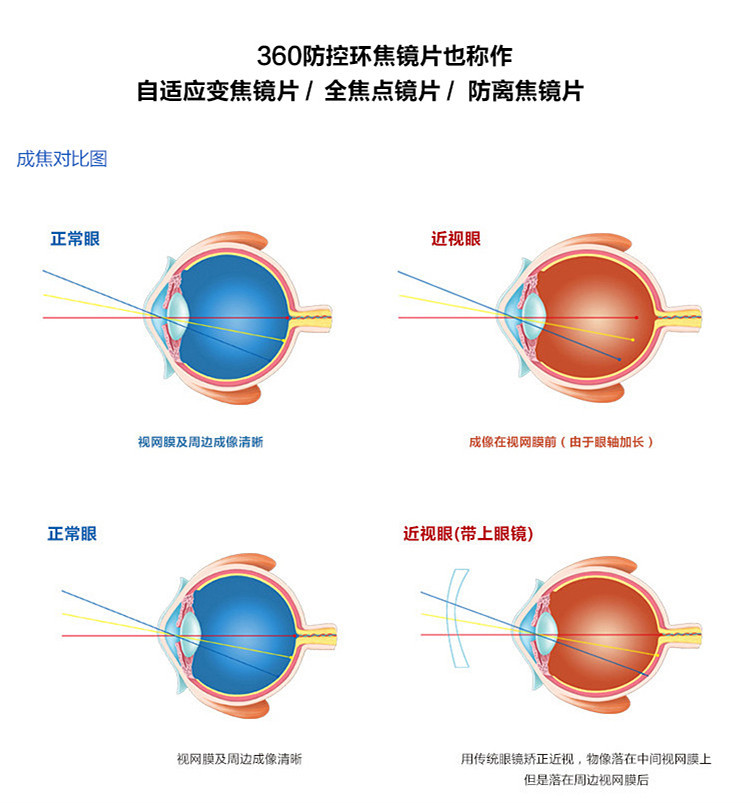 56多功能数码全焦360环焦防蓝光近视防紫外线周边离焦镜片