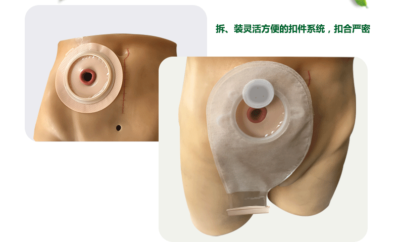 思泰利二件式肛肠造口袋底盘剪孔范围25-57mm 肛门造口造瘘大便袋