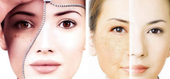 3,光子嫩肤价格与治疗的皮肤范围和皮肤的好坏程度决定,需要操作的