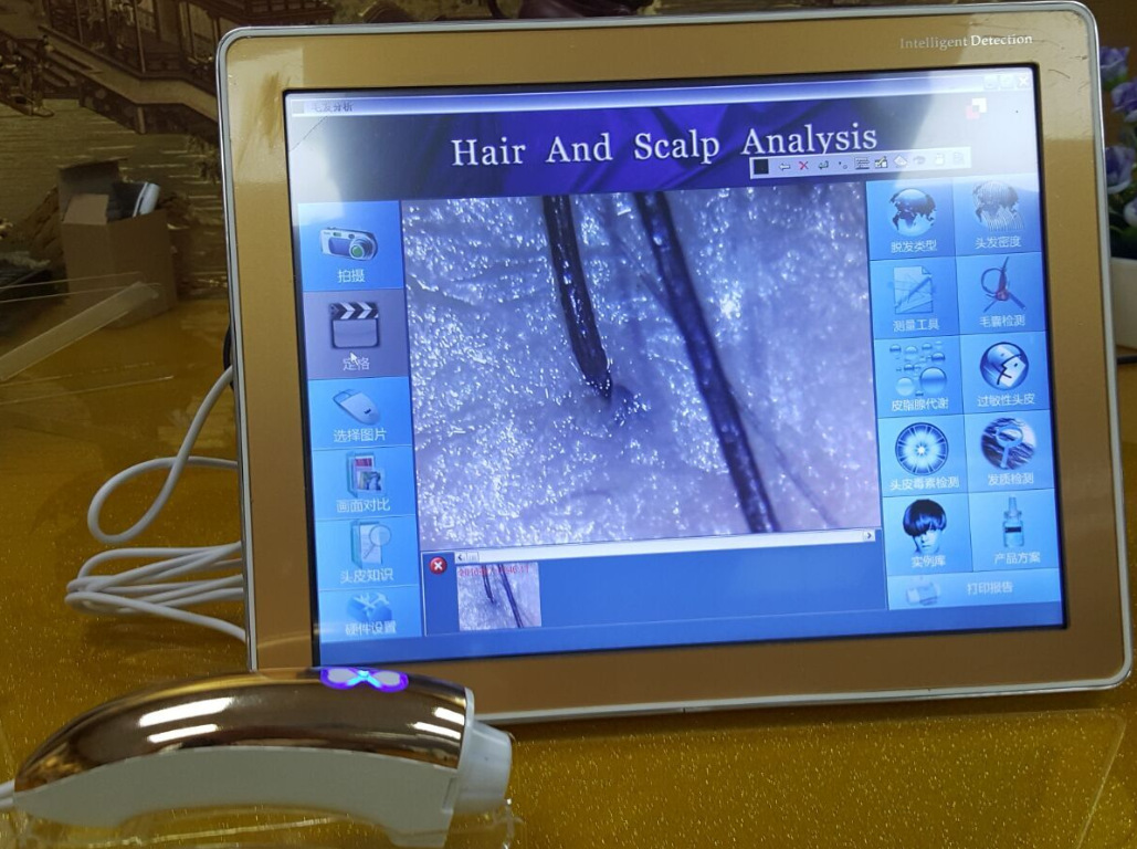 新款智能毛发分析仪头发测试仪毛囊头发 头皮检测仪高清一体机