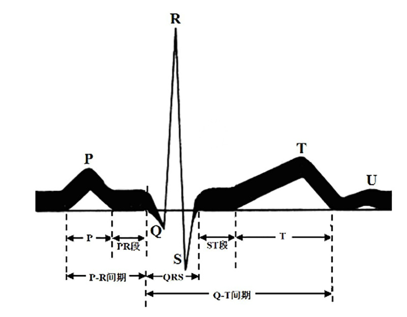 好朋友心电图机家用100法:在家测出r波递增不良怎么办?