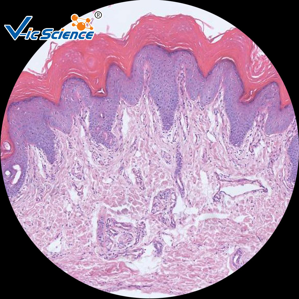 角化的复层扁平上皮图,食道,手绘图_大山谷图库