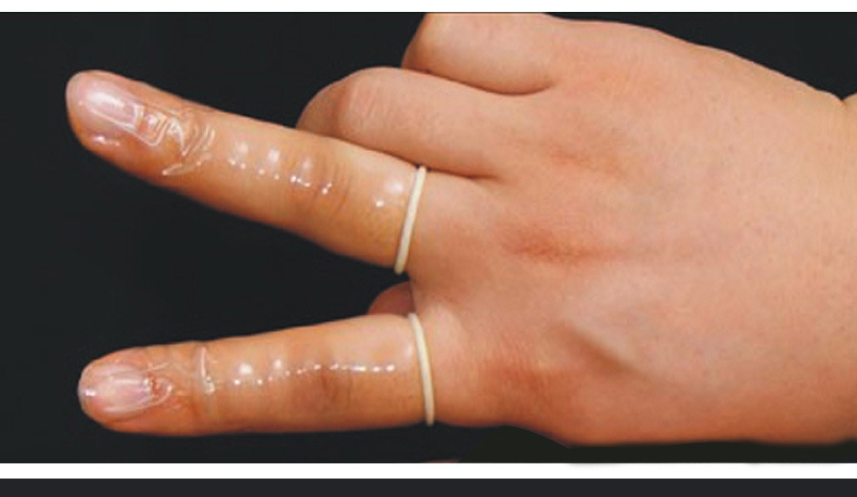 倍力乐qq套避孕套 10只装安全套抠抠套手指套 成人情趣性用品批发