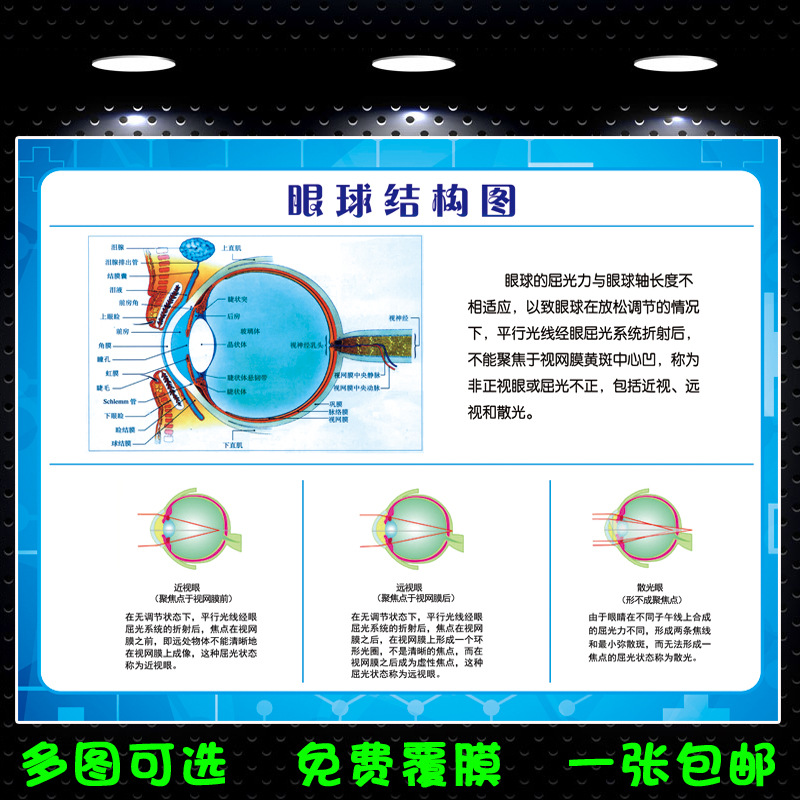 人体眼球的结构图解剖图大挂画 眼睛各结构功能眼部概观全息图片