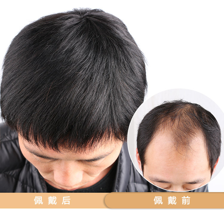 男士补发块寸头短发地中海秃顶真发遮白发自然逼真透气假发补发顶