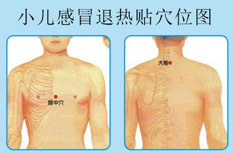 感冒贴儿童位置图解图片