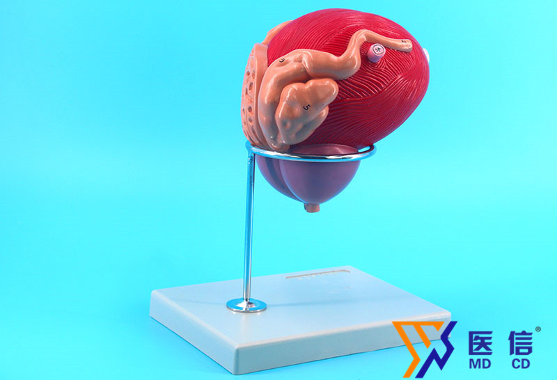 人体膀胱放大模型 医学专用 放大3倍