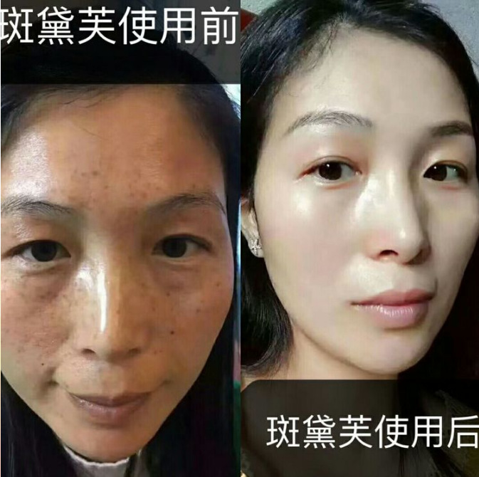 岳华先生是中国唯一一个把美业的身份推上央视报道和联合国国际舞台的