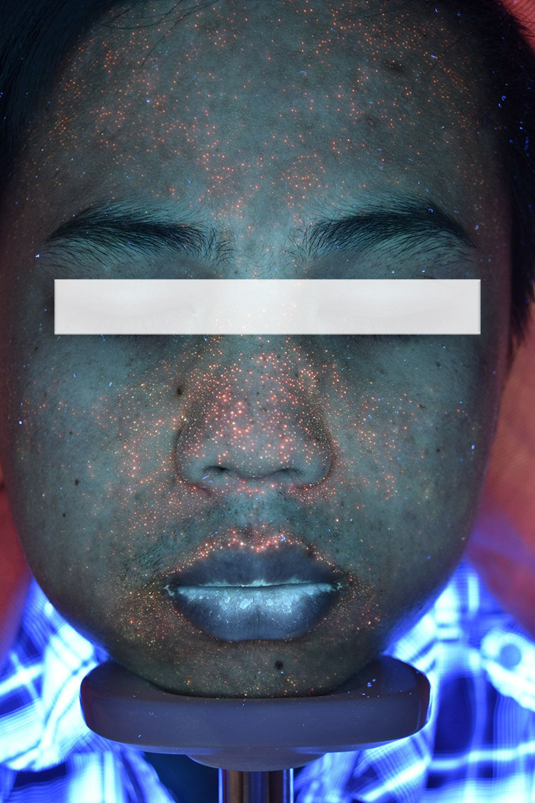 【终身保修】cbs云镜 boxster版 8光谱全脸皮肤检测分析仪 魔镜仪