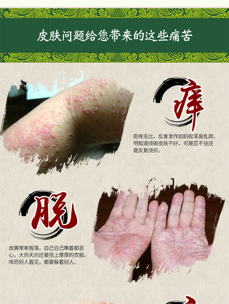 将王范草本乳膏黄色皮肤软膏