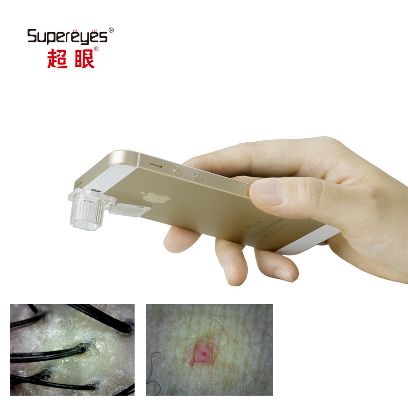 超眼手机40倍毛囊皮肤头皮肤毛孔放大镜电子数码200倍显微镜s001