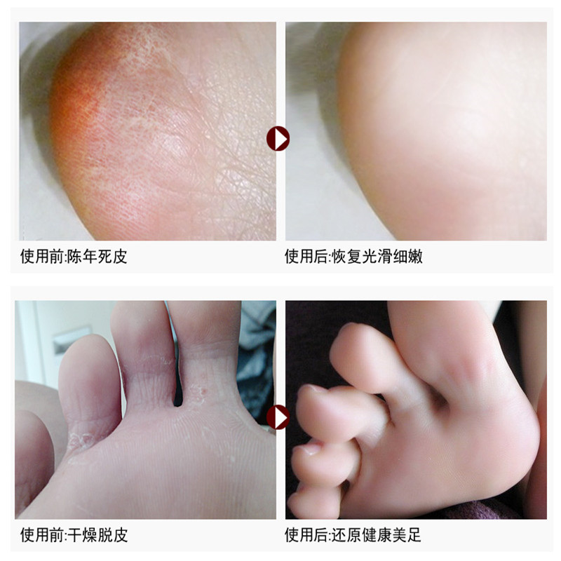 脚膜不脱皮足膜嫩白保湿手膜补水滋润脚套足套脚后跟干裂脚底干燥