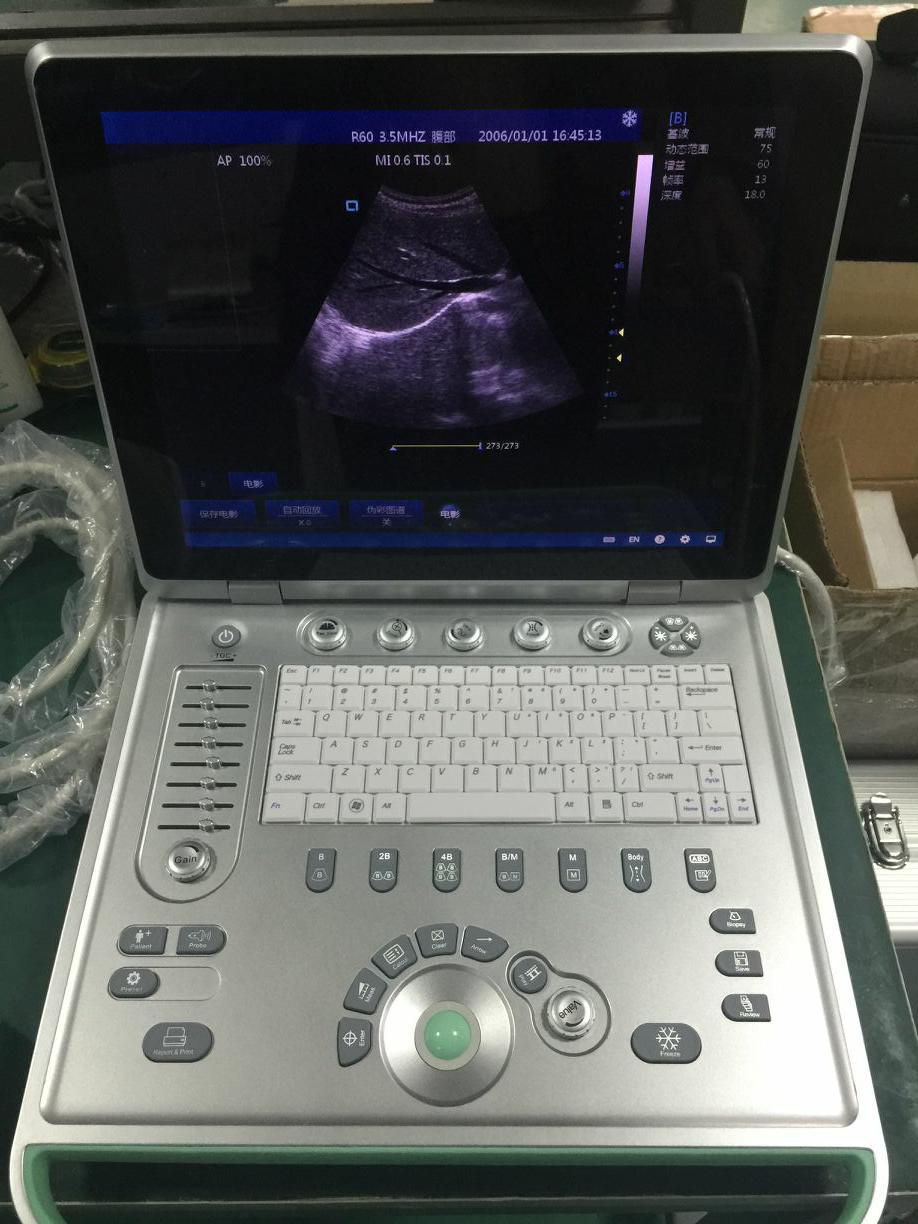索诺星便携式b超机超声波诊断仪医疗笔记本式b超伪彩黑白b超