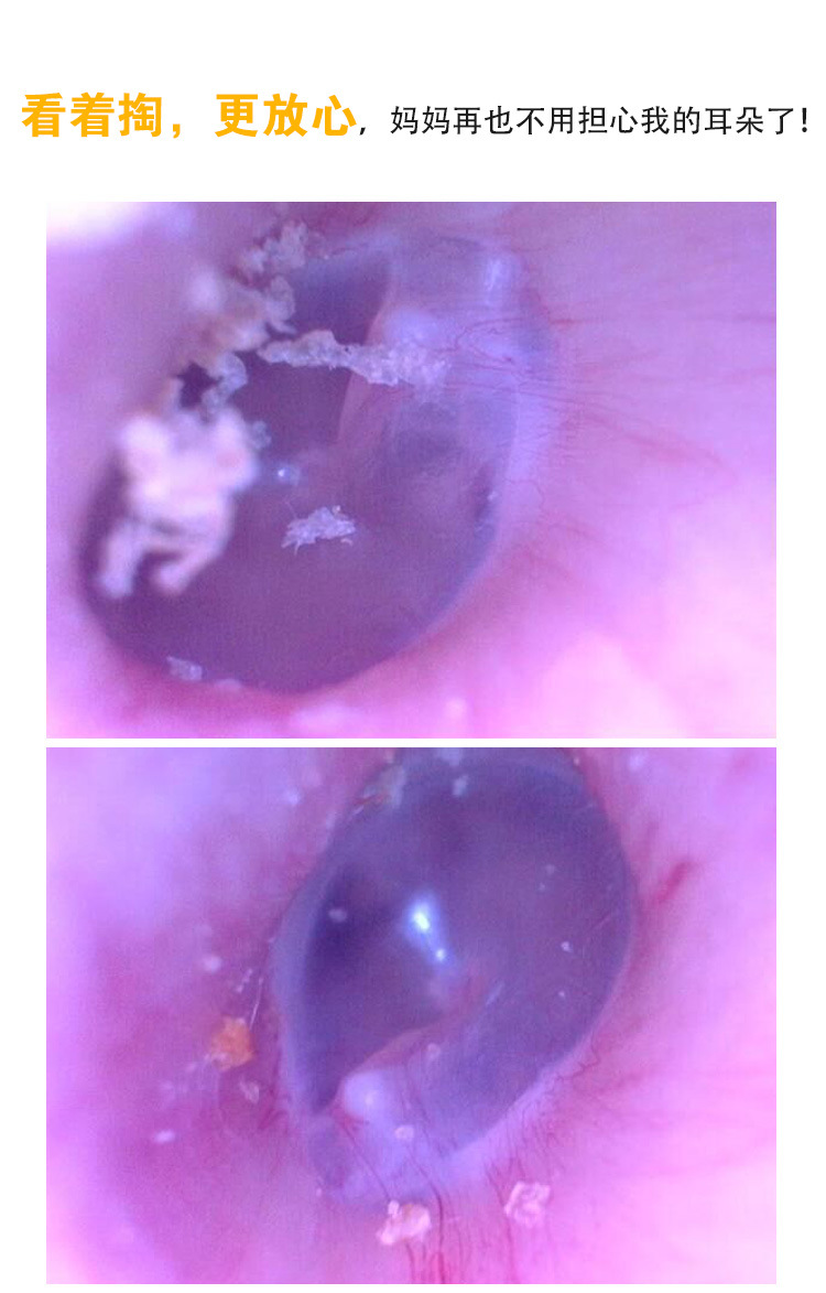 多功能,既可检查耳道,又可检查耳膜,口腔,牙龈,咽喉,鼻腔,头皮发根及