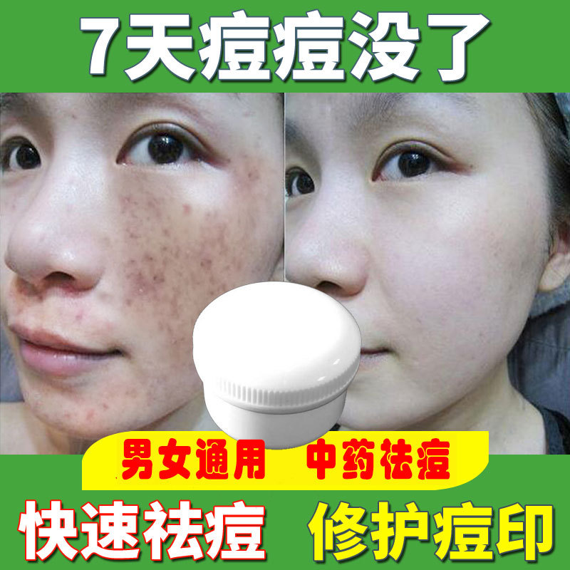 正品小白盒面霜快速祛痘痘印焕颜霜去痘膏男女士批发化妆品