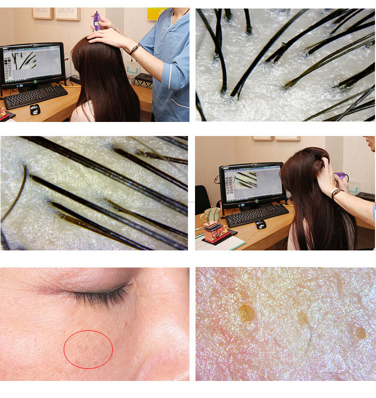 美容皮肤测试仪毛发毛囊头皮头发检测仪usb接电脑高清数码显微镜