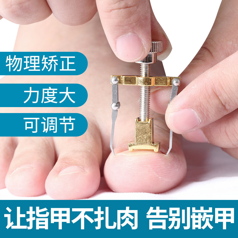 甲沟嵌甲矫正器卷甲修脚趾正甲长肉里矫正器肉包甲纠正器修脚套装