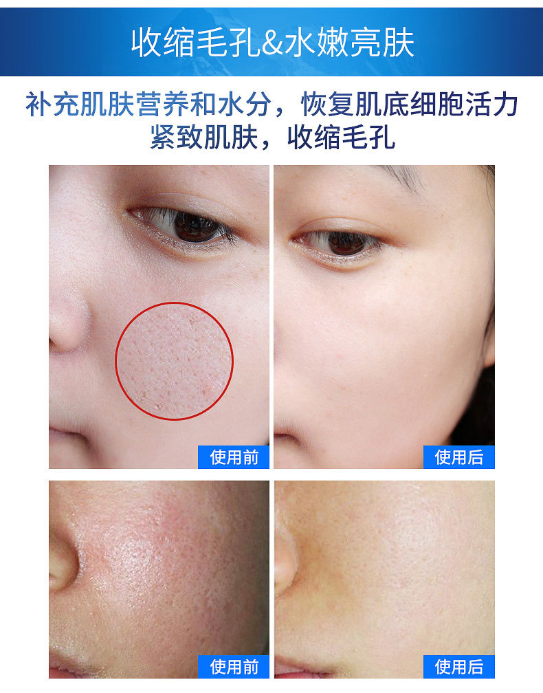 暨大抗老浅导冻干粉套盒 v脸提亮嫩肤美容院美塑组合套装