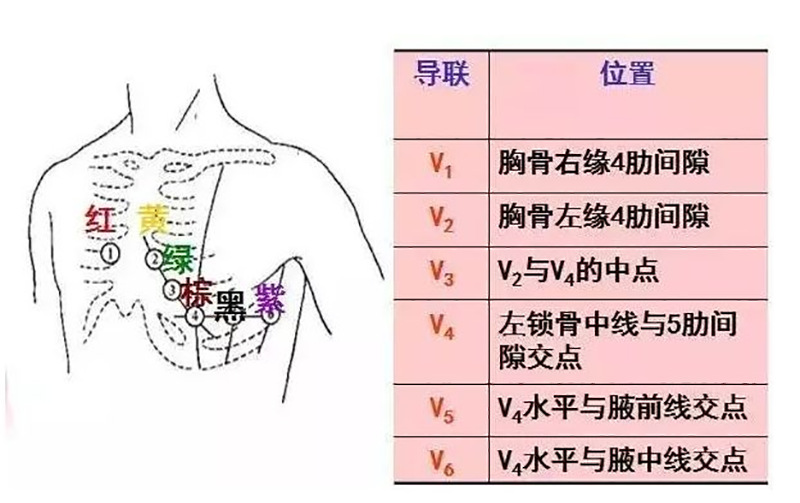 心电图十八导联位置图图片