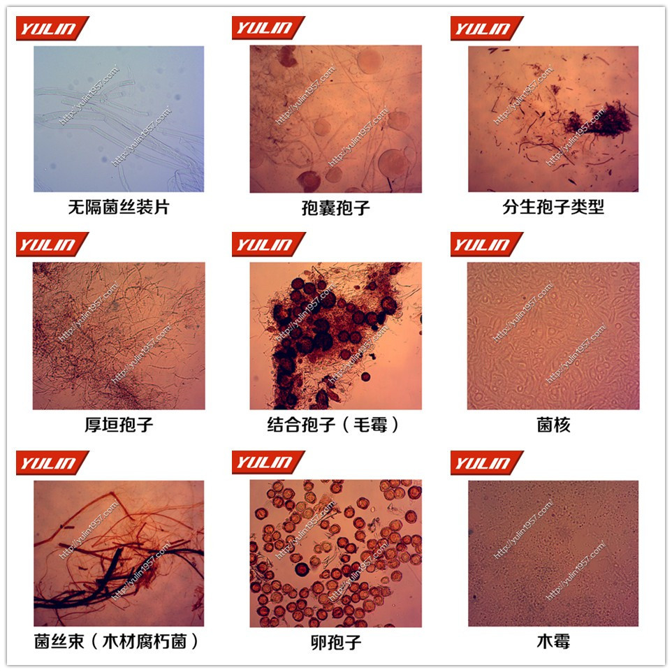 植物病理学 生物切片无隔菌丝(瓜果腐霉菌丝体)