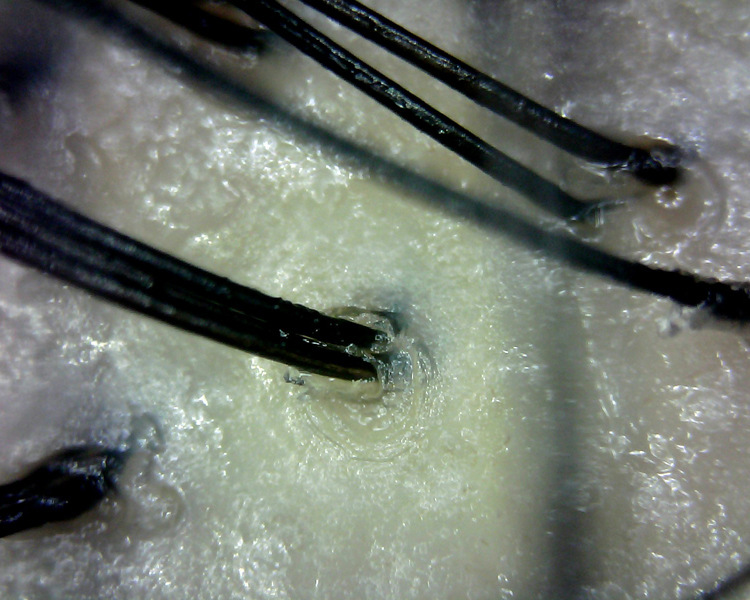 超眼人气电脑手机头皮皮肤毛孔毛囊检测仪数码电子显微放大镜b010