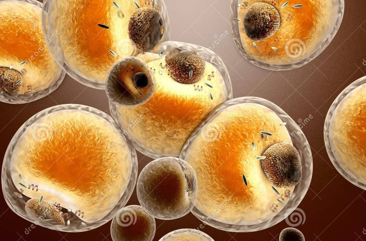 是人体营养过剩时(先天性肥胖除外),身体会把多余的脂肪贮存在皮下,长