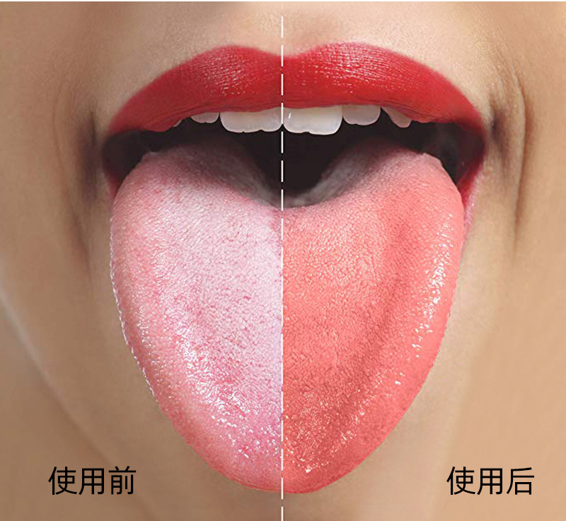 304不锈钢刮舌器 舌苔清洁器成人去口臭口气清新口腔护理刮舌头板