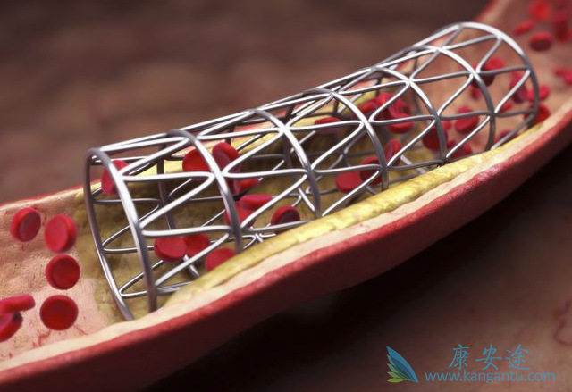 g江苏无锡真空钎焊炉镍钛血管支架胆管支架真空热处理定型设备cbn