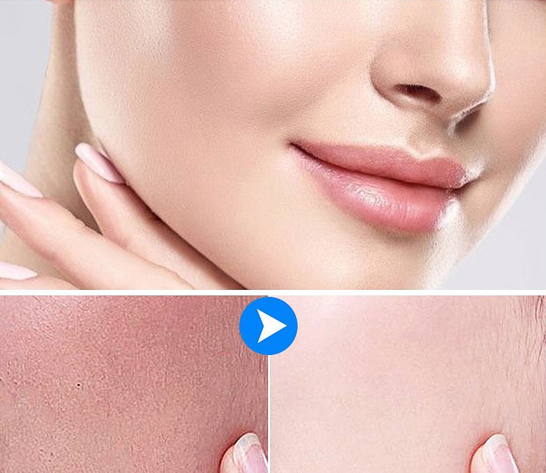 植物海绵微针焕肤微晶粉海藻矽针 暗沉粉刺 毛孔粗大